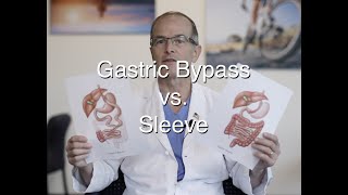 Gastric Bypass vs Sleeve update for 2021 [upl. by Lotz]