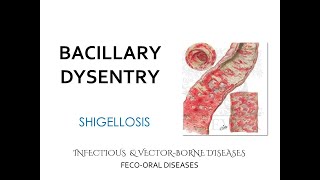 FecoOral diseases Bacillary Dysentery Shigellosis Lecture [upl. by Winny744]