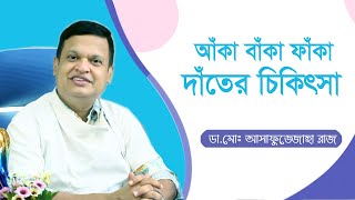 আঁকা বাঁকা ফাঁকা দাঁতের চিকিৎসা  Dental Bridges Bangla Tips  DRMD Asafujjoha Raj  Doctor Tube [upl. by Yardley]