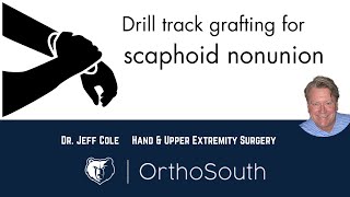 Scaphoid Nonunion Drill Track GraftingDr Jeff ColeOrthoSouth [upl. by Enellek]