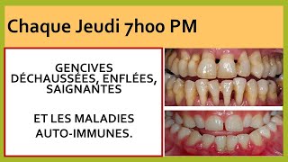 Brossage des dents et maladies inflammatoires [upl. by Nosdrahcir]