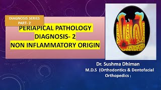 Periapical Pathology  Non inflammatory and non odontogenic lesions [upl. by Morry686]