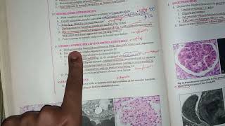 renal pathology revision from pathoma [upl. by Reynard424]