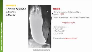 Cap 66 Fisiología de los trastornos gastrointestinales [upl. by Anelem]