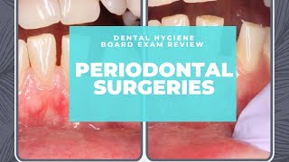 NBDHE  DENTAL HYGIENE BOARD EXAM REVIEW Everything you need to know about Periodontal Surgeries [upl. by Mclyman]