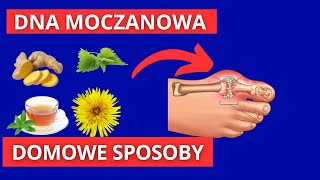 Dna Moczanowa  Domowe Sposoby na Kwas moczanowy DNĘ oczanową [upl. by Esidnak]