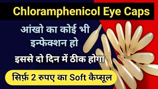 chloramphenicol eye ointment how to apply  chloramphenicol eye drops  chloramphenicol [upl. by Nerhtak]