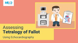 Assessing Tetralogy of Fallot Using Echocardiography [upl. by Per]