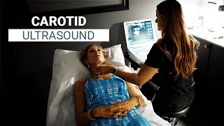 Carotid Ultrasound Essential for Stroke Prevention  Senolytix [upl. by Nepil]