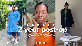 2 years postop gastric bypass update  current weight size amp portions [upl. by Adim]