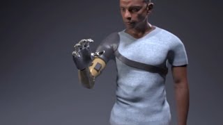 Bionic Arm That Restores Natural Movements Sensation and Touch [upl. by Elie]