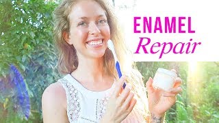 How I Naturally Restored My Enamel and Remineralized My Teeth [upl. by Katheryn]