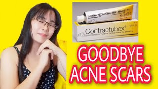 UPDATEPROVEN SCAR TREATMENT CONTRACTUBEX GEL FOR MY OLD  NEW SCARS ACNE AND FOR MY KELOID [upl. by Bonnice820]