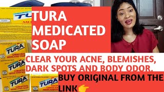 TURA MEDICATED SOAPTO CLEAR ACNE BODY ODOUR BLEMISHES DANDRUFF DARk SPOTUSE AS ANTIBACTERIAL [upl. by Kajdan739]