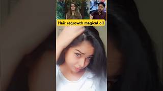 Hair re growth oil hairregrowthoil hairgrowth hairoil hairfall hairloss oil shorts hairserum [upl. by Aimas]