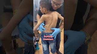 chiropractor Scoliosistreatment rkm drrajneeshkant [upl. by Yrrol]