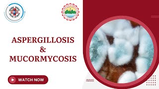 Aspergillosis amp Mucormycosis [upl. by Arly]