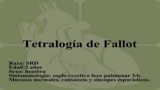 Tetralogía de Fallot [upl. by Suiluj]