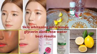 glycerine and rose water for skin whitening  glycerin for skin whitening su beauty and remedies [upl. by Andrus]