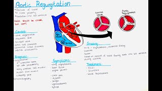 Aortic Regurgitation  Causes Symptoms Diagnosis Treatment Grading [upl. by Lundgren806]