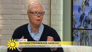 Lasse hamnade mitt i eldhavet  quotJag trodde att jag skulle döquot  Nyhetsmorgon TV4 [upl. by Teak621]