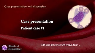 Patient case presentation case 1 [upl. by Kynthia]