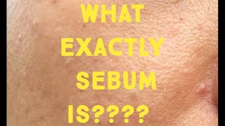 What is sebum How it cause acne [upl. by Maitland]