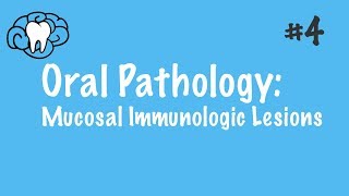 Oral Pathology  Mucosal Immunologic Diseases  INBDE ADAT [upl. by Galina]