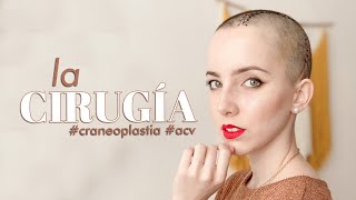 LA CIRUGIA craneoplastia acv [upl. by Steinman]