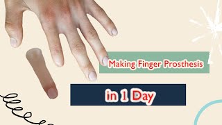 making Finger prosthesis  index finger lost  prosthesis  Custom finger prosthesis [upl. by Meekah]