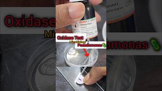 Oxidase Test 🧫🧪🔬🦠 Biochemicaltest  Microbiology Lab  Basics biochemistry shorts microbiology [upl. by Nylirad519]