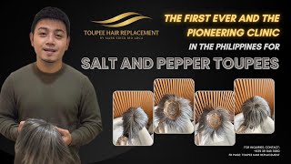 Toupee Hair Replacement Salt and Pepper Color 😎 [upl. by Talmud]