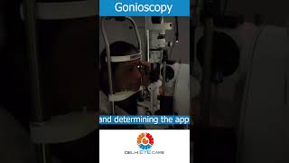 Gonioscopy is an Eye Examination Technique to view the Iridocorneal Angle  Dr Nidhi Gupta eyes [upl. by Popper]