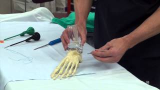 Dr Moore Explains Ankle Ligament Repair and Reinforcement Using the Arthrex Internal Brace [upl. by Narmis]