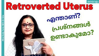 Retroverted Uterus  റിട്രോവെർട്ടഡ് യൂട്ടറസ്  പ്രശ്നങ്ങൾ ഉണ്ടാകുമോ  Dr Sita  Malayalam [upl. by Madelle]