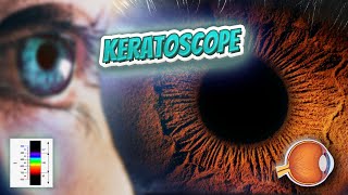 Keratoscope Your EYEBALLS 👁️👁️💉😳💊🔊💯✅ [upl. by Leahcim]