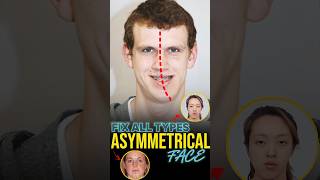 Fix Facial Asymmetry [upl. by Tombaugh]