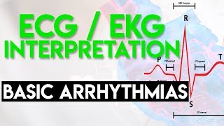 Basic Arrhythmias  Sinus Brady Tachy Premature Beats  ECG EKG Interpretation Part 3 [upl. by Ailecra]