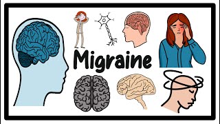 Migraine Headache Causes Symptoms amp Treatment Guide [upl. by Aletta]