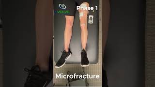 The Best Quadriceps Strengthening Exercise In Phase 1 Of Microfracture Rehab [upl. by Sara698]