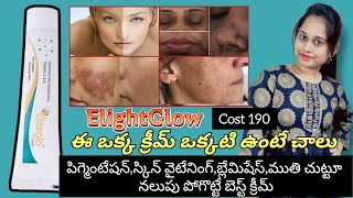 Eliteglo cream review in teluguGet permanent skin whitening remove dark spots reduce pigmentatio [upl. by Melissa98]