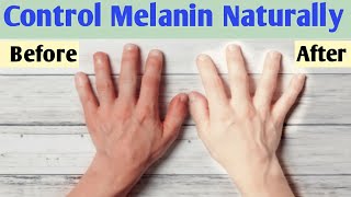 How to reduce melanin in skin naturally  Melanin kam karne ke upay [upl. by Snider]