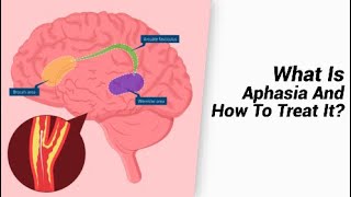 What Is Aphasia And How To Treat It [upl. by Nuriel]