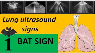 lung ultrasound signsBat sign [upl. by Ahsuatan787]