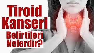 TİROİD KANSERİ BELİRTİLERİ NELERDİR [upl. by Zeba691]