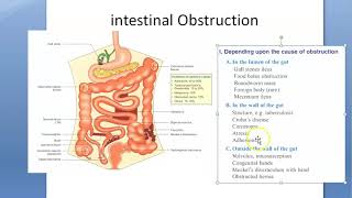 Surgery Causes Intestinal Obstruction Type Classify Dynamic Mechanical ADynamic Neurogenic Ogilvie [upl. by Nwahsid]