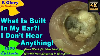 What Is Built In My Ear😴I Dont Hear Anything😏New Video Ear Wax Removal😍 1079 earwax ear [upl. by Menashem410]