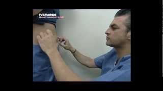 Lipolyse de labdomen par le Docteur Thierry LAFITTE TV5 Mondemp4 [upl. by Cherlyn]