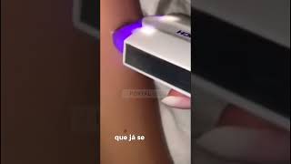 Depilador a laser profissional DepiHair [upl. by Sidra697]