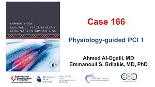 Case 166 Manual of PCI  Physiologyguided PCI 1 [upl. by Nennarb280]